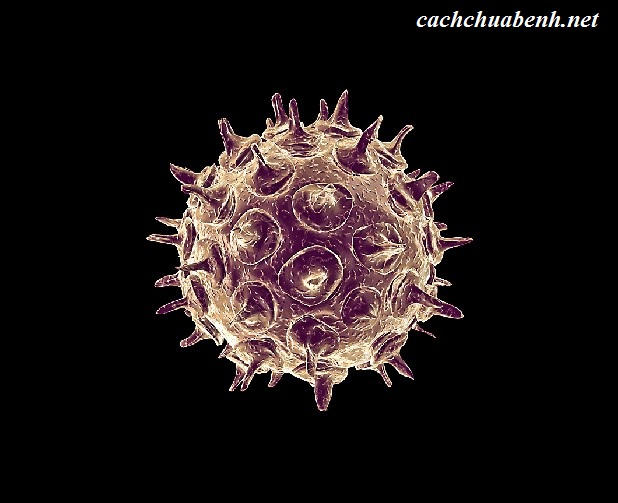 Virus Rubella